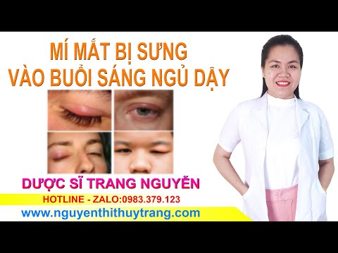 Video Mí mắt bị sưng sau khi ngủ dậy nguyên nhân do đâu - youtube