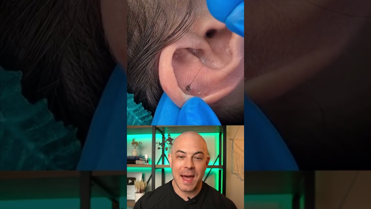Derm Reacts To A HAIRY Situation Dermreacts Doctorreacts Piercing