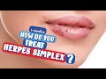 How do you Treat Herpes?👨‍⚕️🩺