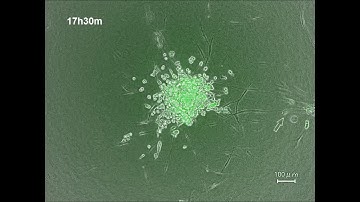 Cancer cell migration on elongate protrusions of fibroblasts in collagen matrix
