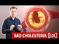 Bad Cholesterol (LDL) is NOT Cholesterol and Is NOT Bad! - Dr.Berg