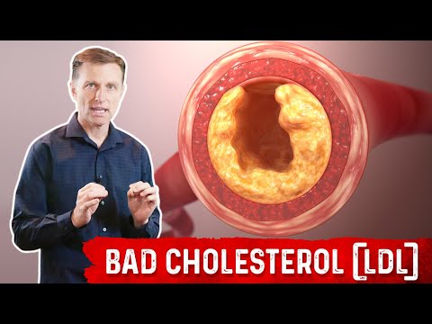 Bad Cholesterol (LDL) is NOT Cholesterol and Is NOT Bad! – Dr.Berg