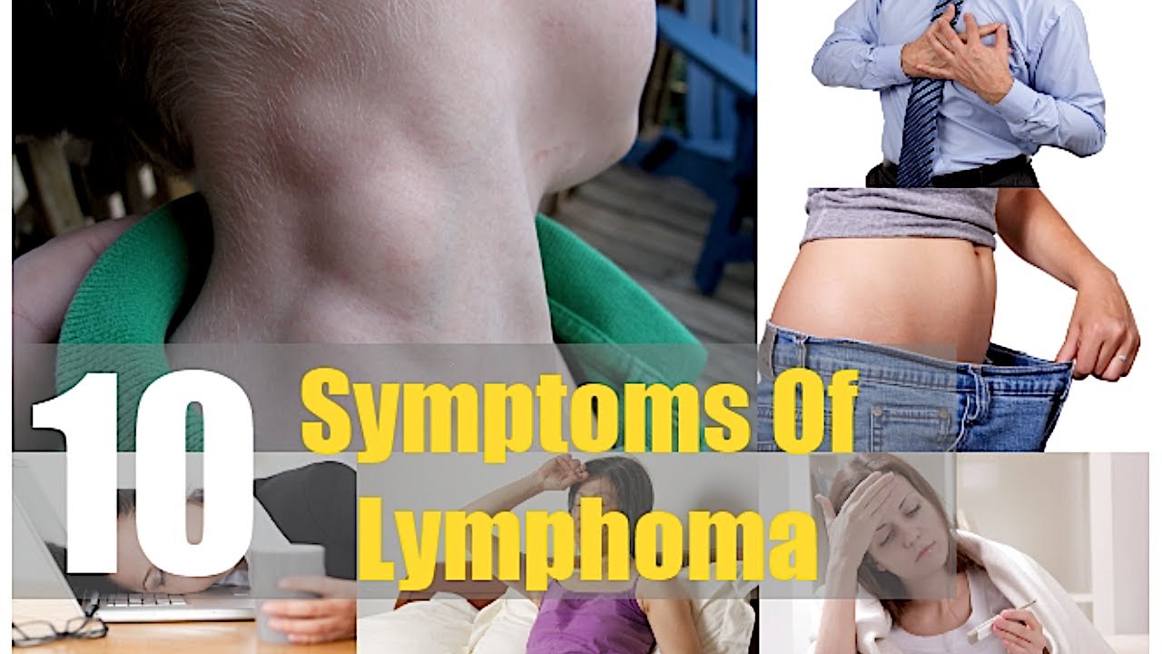 Top 10 Symptoms Of Lymphoma Ignored By Men And Women Swollen Lymph