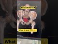 3D reconstruction. #nuclearmedicine #3dreconstruction #radiology #anatomy #science #facts