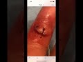 #stitches #funny
