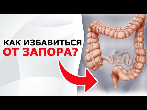 КАК УСТРАНИТЬ ЗАПОР | 3 причины и 3 ПРОСТЫХ способа, как НАВСЕГДА избавиться от запоров БЕЗ ЛЕКАРСТВ