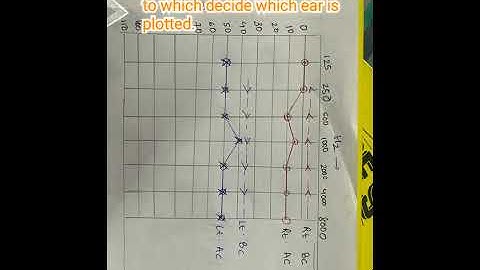 Steps to read an audiogram