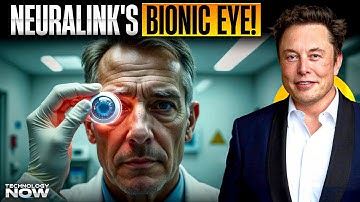 Neuralink’s Bionic Eye: Elon Musk’s Vision Restoration Breakthrough is Here