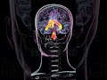#anatomy #brain #brainscan #mriscan #mribrain #mri #radiology #radiologiest #radiographer #ctscan