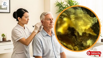 Giant Ear Wax Pick Out | Satisfying Ear Cleaning with Relaxation