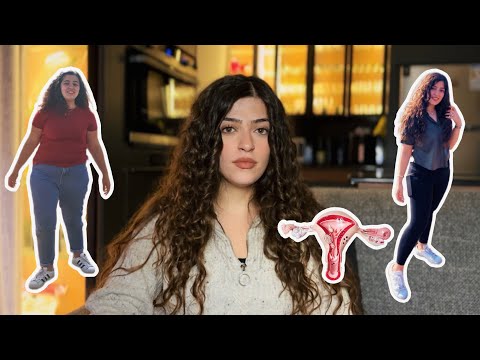 رحلتي مع متلازمة تكيس المبايض كيف نحفت ٢٠ كيلو