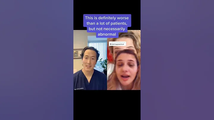 Plastic Reacts to Nose Job Recovery! #shorts #nosejob