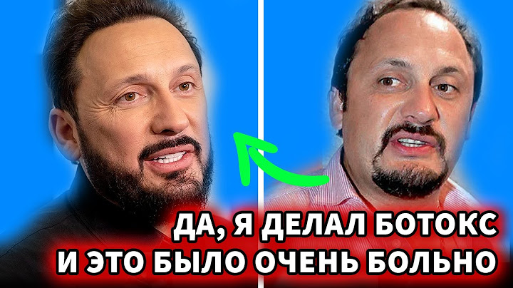 Стас Михайлов об «уколах красоты» и пересадке волос