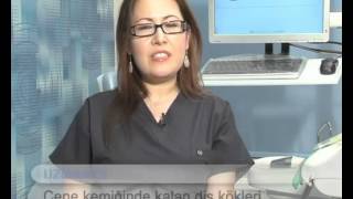 Çene kemiğimde diş kökü kaldı nasıl temizlenebilir?-Fulya Özbey Erkılınç