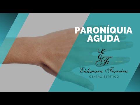 PARONÍQUIA AGUDA - Eidimara Ferreira