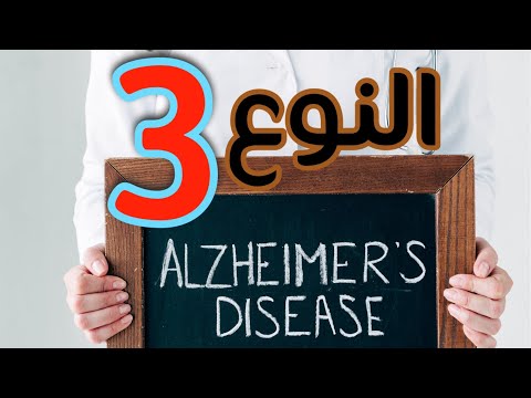 أهم أسباب الزهايمر