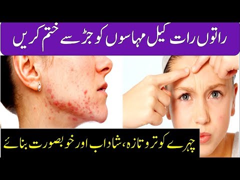 Acne Scars Removal - How To Get Rid of Acne Scars With Homemade Effective Remedies Urdu Hindi