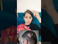 Acne, Gout, varicose vein जैसी गंभीर बीमारियों का इलाज सिर्फ इस छोटी सी चीज से हो सकता है 🌱🌿