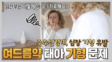 임산부의 여드름약 복용은 태아에게 얼마나 치명적일까?