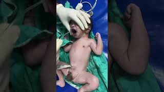 Newborn resuscitation #viral #chinna #youtubeshorts #shorts #youtube #cute #kids #doctors