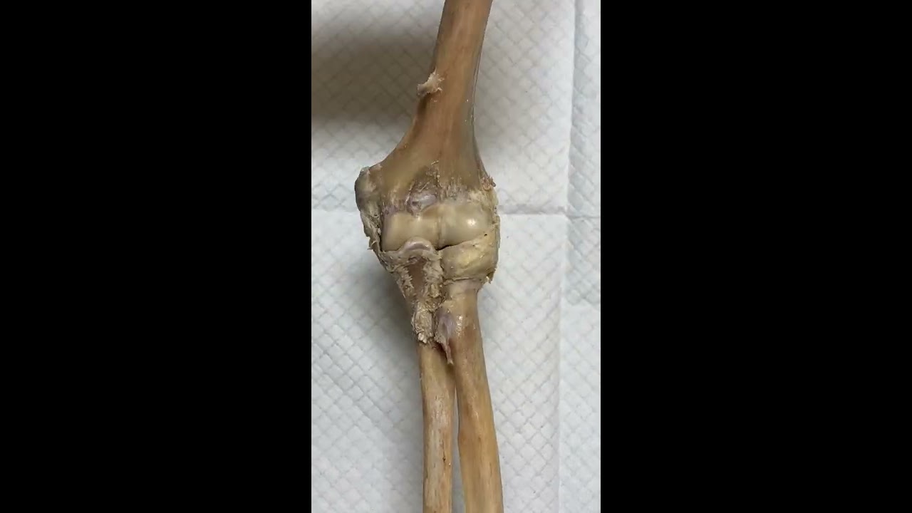 Elbow Joint