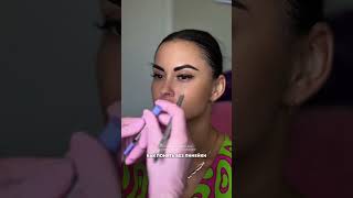 Как поднять брови ботулотоксином