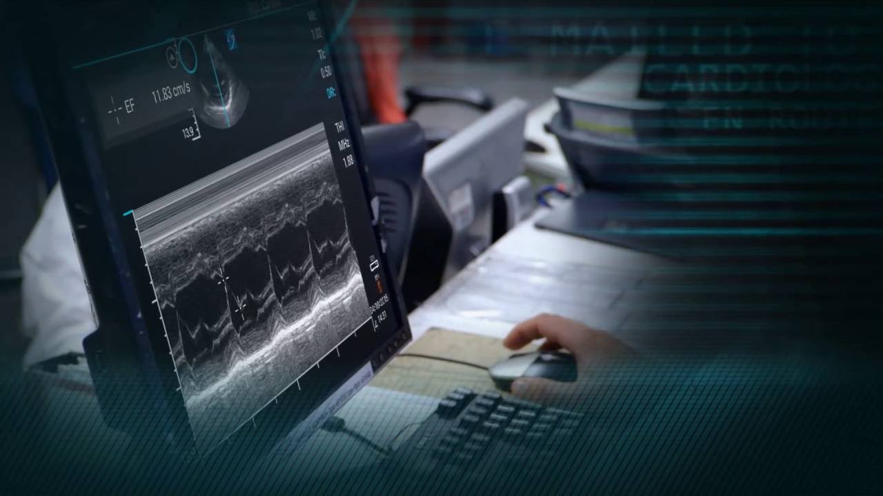 sonosite m turbo usado SonoSite iViz Ultrasound System: Mobility.