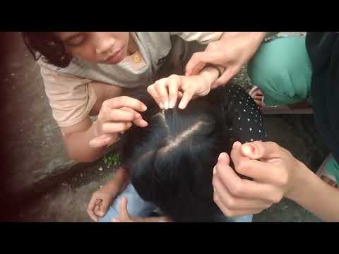Video: 4 Cara Mencari Kutu di Rambut