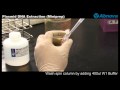 Plasmid dna extraction miniprep