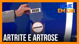 Você e o doutor: Dr. Sproesser explica sobre a artrite e a artrose