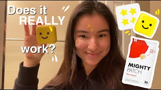 I TRIED MIGHTY PATCHES & STAR FACE FOR A WEEK / Mighty patch Vs. Star Face