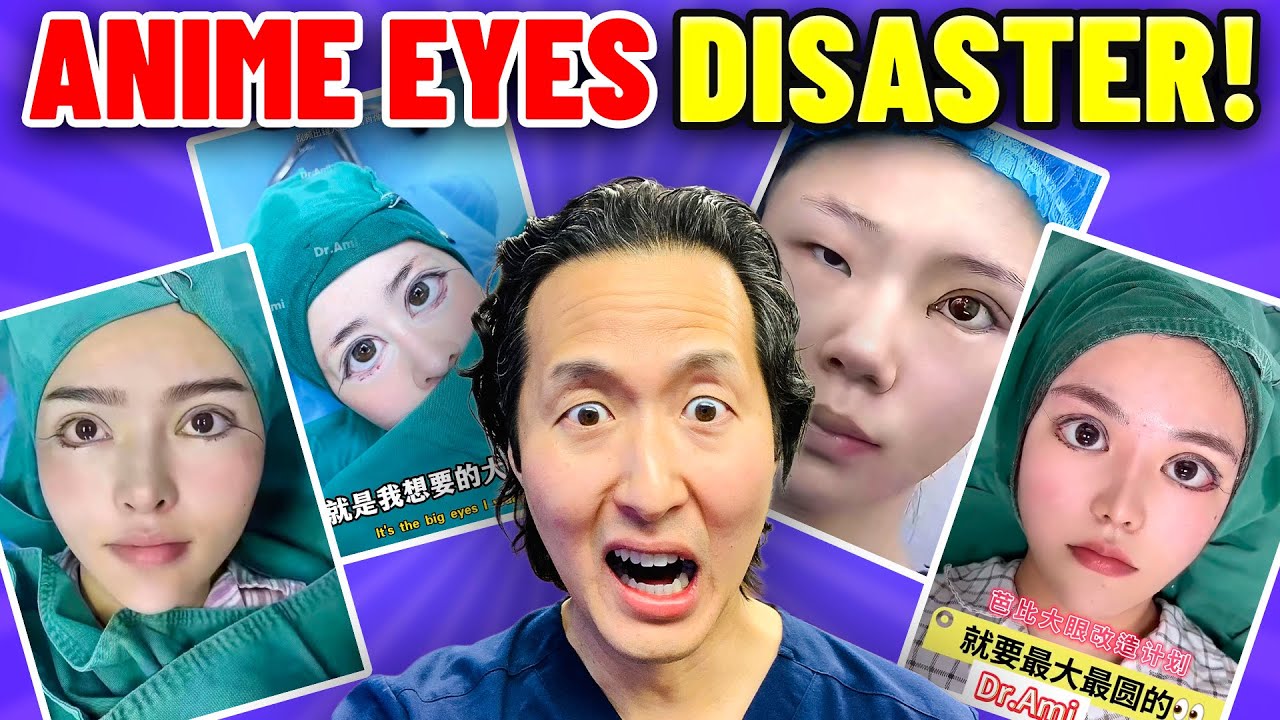 They Wanted Anime Eyes… Now They Can’t Close Them! Plastic Surgeon Reacts…