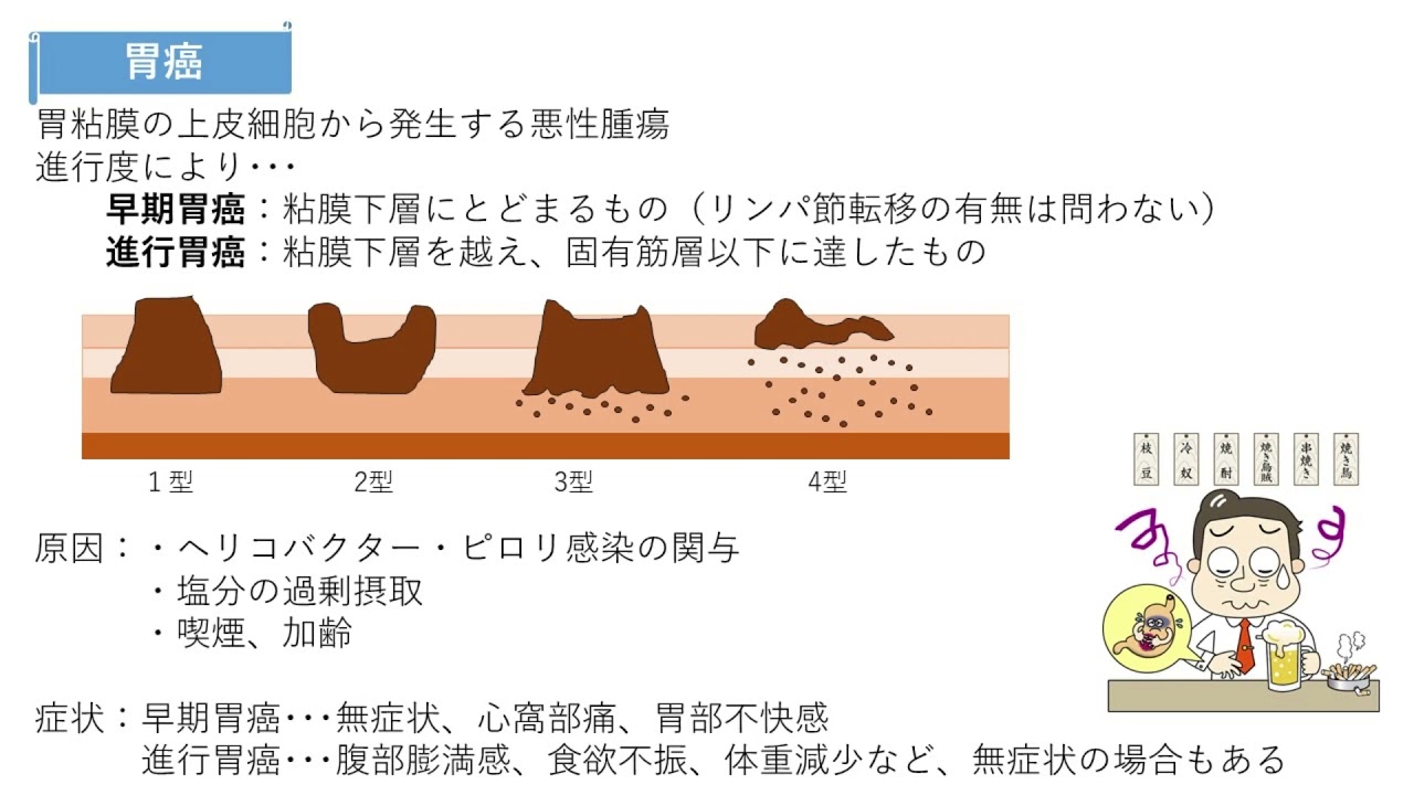 播種性転移はどれか – 腹膜播種性転移 | 日本がん転移学会 – NXFJO