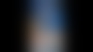 Robotic Cystectomy with Intracorporeal Urinary Diversion