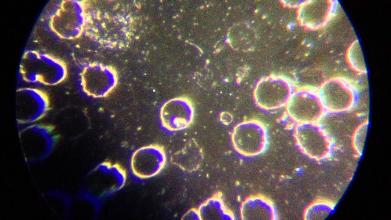 Lyme Spirochete Bacteria Australia Dark Field 2 Close Up YouTube