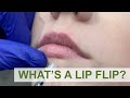 What's a lip flip?!