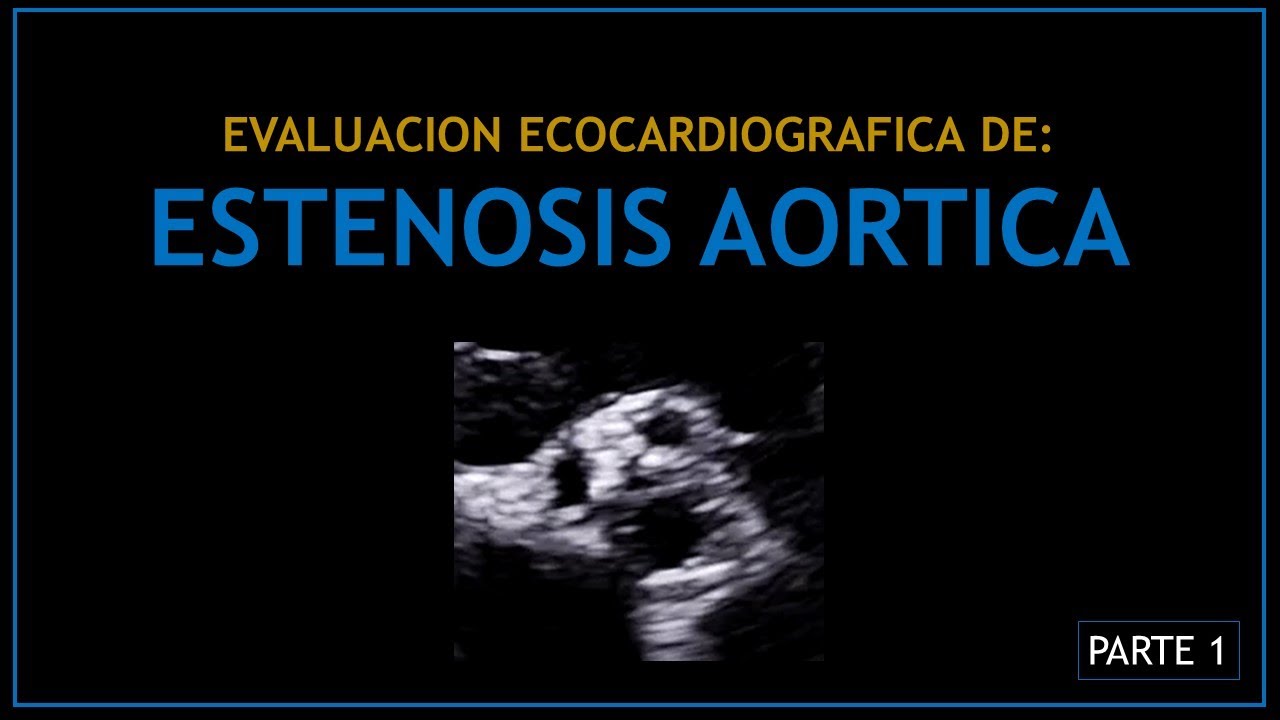 ESTENOSIS AORTICA (Evaluacion ecocardiografica) - PARTE 1