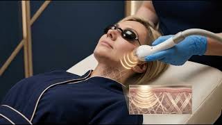 How RF Skin Tightening Works Radio Frequency Treatment in Mesa Glendale AZ