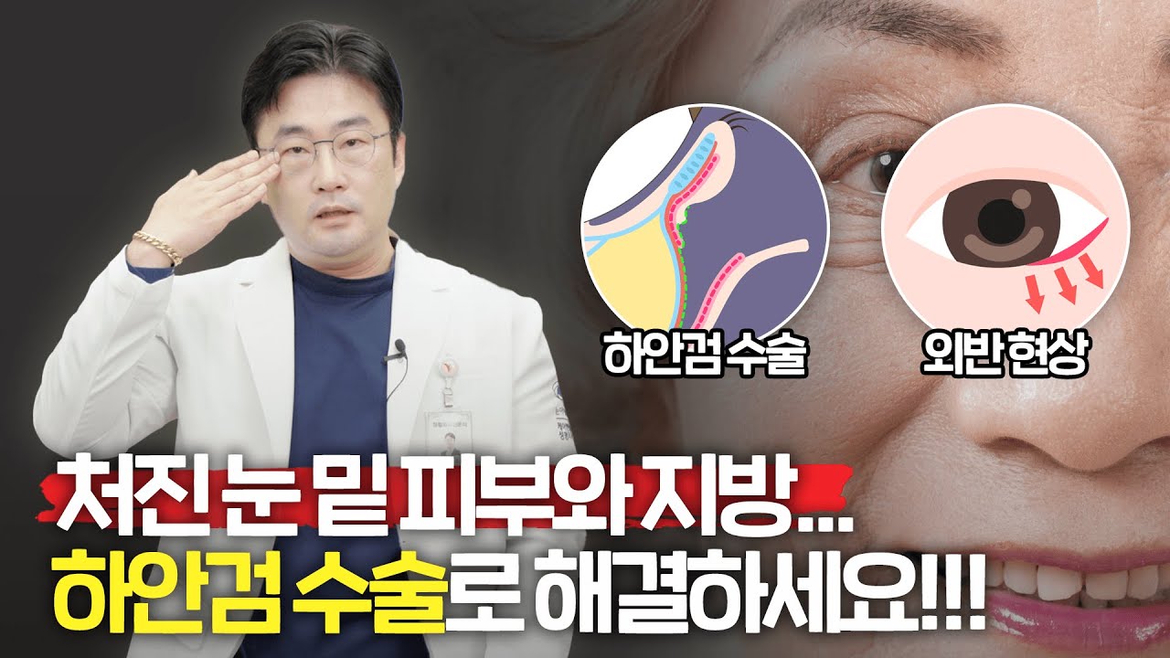 애교 살은 살리고, 부작용은 없애는 하안검 수술 노하우!!_[부산 케이엔젤 성형외과]