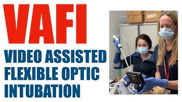 Video Assisted Flexible-optic Intubation