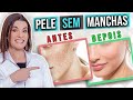 5 Melhores ÁCIDOS que Você Deve Usar Para Clarear Manchas na Pele