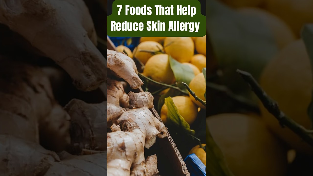 Top 7 Foods to Reduce Skin Allergies Naturally