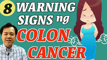 8 Warning Signs ng Colon Cancer - By Doc Willie Ong #1081