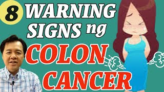 8 Warning Signs Ng Colon Cancer - By Doc Willie Ong 