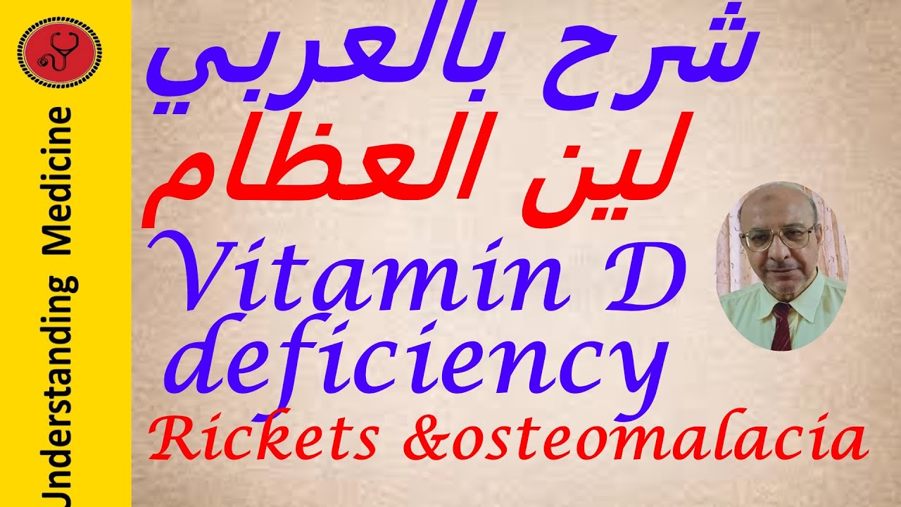 Vitamin D , deficiency ,Rickets and Osteomalacia شرح بالعربي نقص