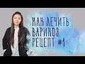 Самое просто лечение варикоза на ногах №1 у женщин и мужчин