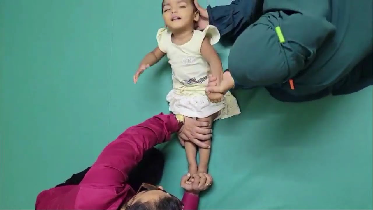 শিশুর বিকাশ জনিত সমস্যা ও সঠিক থেরাপি | Therapy provided for developmental problems in children