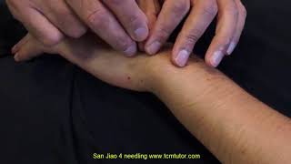 How To Needle San Jiao 4 Yangchi Yang Pool