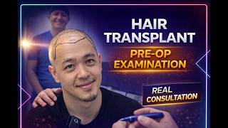 From Consultation to Day 1 Results: 3540 Grafts Asian Hair Transplant