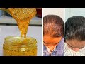 Hal Basal Maheysa Sirta Timaha Dhereysa Cajib Secret For Hair Growth
